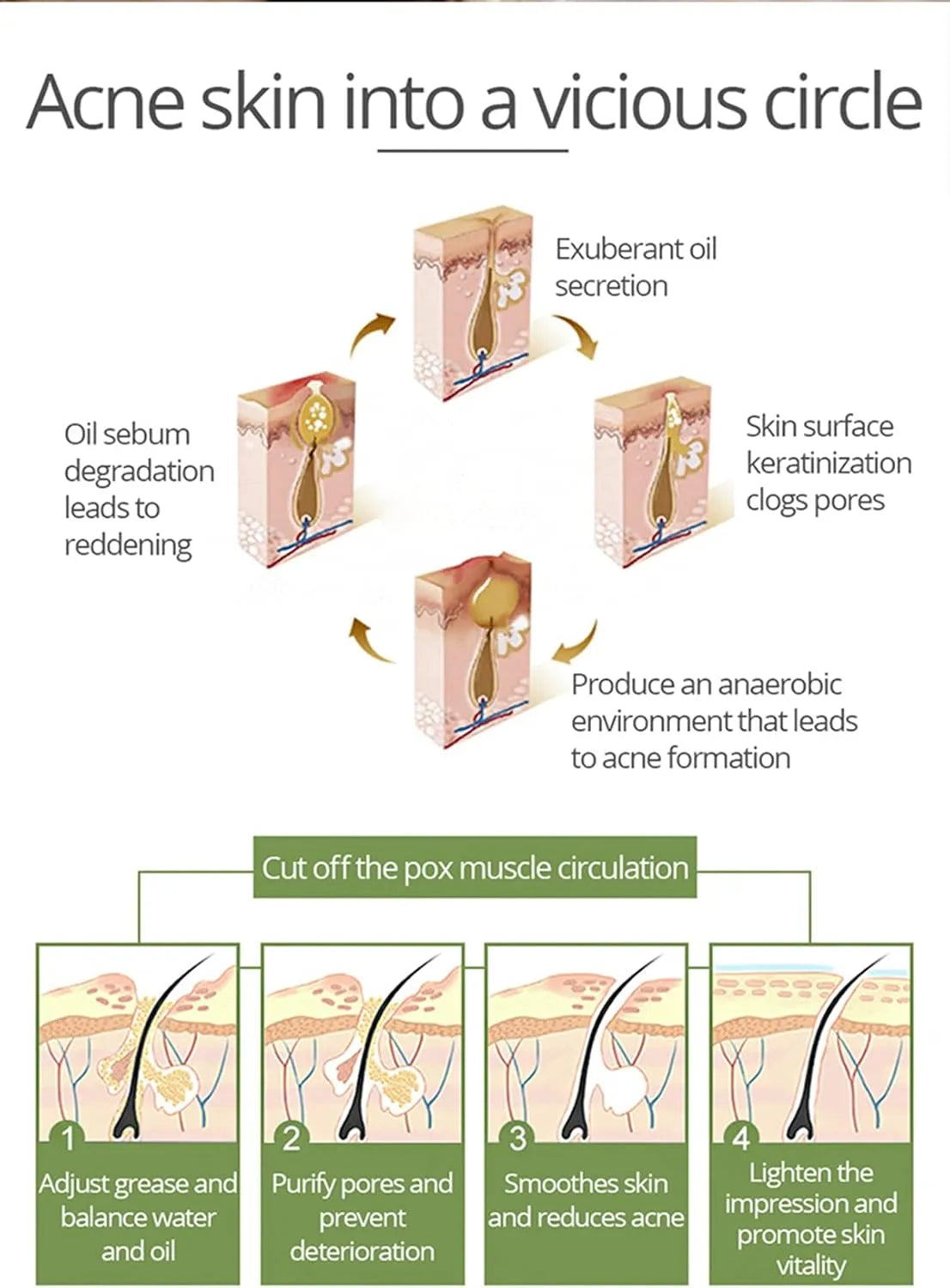 Aichun Beauty Anti-Acne Whitening Facial Serum – 30ml